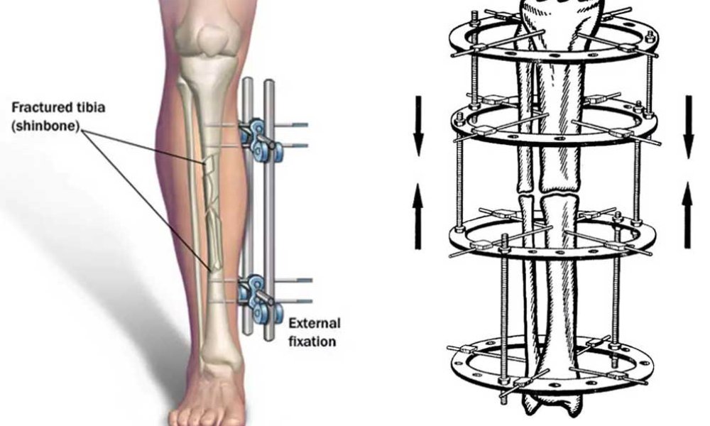 Latest trauma center in Anand